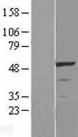 Western blot validation of overexpression lysate (Cat# LY424705) using anti-DDK antibody (Cat# <a href = "https://www.origene.com/catalog/antibodies/tag-antibodies/ta50011-100-clone-oti4c5-anti-ddk-flag-monoclonal-antibody" title="TA50011-100" class="">TA50011-100</a>). Left: Cell lysates from un-transfected HEK293T cells; Right: Cell lysates from HEK293T cells transfected with <a href = "https://www.origene.com/catalog/cdna-clones/expression-plasmids/rc202885-lkb1-stk11-nm-000455-human-tagged-orf-clone" title="RC202885" class="">RC202885</a> using transfection reagent MegaTran 2.0 (Cat# <a href = "https://www.origene.com/catalog/others/transfection-reagents/tt210002-megatran-20-plasmid-dna-transfection-reagent-05-ml" title="TT210002" class="">TT210002</a>).