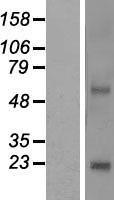 Western blot validation of overexpression lysate (Cat# LY407181) using anti-DDK antibody (Cat# <a href = "https://www.origene.com/catalog/antibodies/tag-antibodies/ta50011-100-clone-oti4c5-anti-ddk-flag-monoclonal-antibody" title="TA50011-100" class="">TA50011-100</a>). Left: Cell lysates from un-transfected HEK293T cells; Right: Cell lysates from HEK293T cells transfected with <a href = "https://www.origene.com/catalog/cdna-clones/expression-plasmids/rc207239-nkain4-nm-152864-human-tagged-orf-clone" title="RC207239" class="">RC207239</a> using transfection reagent MegaTran 2.0 (Cat# <a href = "https://www.origene.com/catalog/others/transfection-reagents/tt210002-megatran-20-plasmid-dna-transfection-reagent-05-ml" title="TT210002" class="">TT210002</a>).