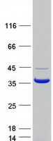 Coomassie blue staining of purified CNN1 protein (Cat# TP305370). The protein was produced from HEK293T cells transfected with CNN1 cDNA clone (Cat# <a href = "https://www.origene.com/catalog/cdna-clones/expression-plasmids/rc205370-calponin-cnn1-nm-001299-human-tagged-orf-clone" title="RC205370" class="">RC205370</a>) using MegaTran 2.0 (Cat# <a href = "https://www.origene.com/catalog/others/transfection-reagents/tt210002-megatran-20-plasmid-dna-transfection-reagent-05-ml" title="TT210002" class="">TT210002</a>).