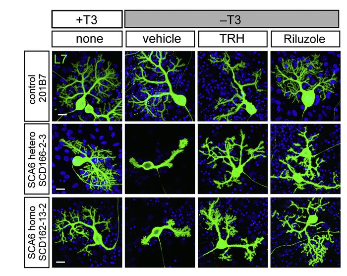 TRH enhances the survival and dendritic maintenance of SCA6 Purkinje cells. High-magnification images are L7+ Purkinje cells in green derived from control, heterozygous, and homozygous iPSCs on culture day 75 in the presence or absence of T3 and with or without TRH 1 (OriGene <a href = "https://www.origene.com/catalog/proteins/recombinant-proteins/tp319231-thyrotropin-releasing-hormone-trh-nm-007117-human-recombinant-protein" title="TP319231" class="">TP319231</a>) or Riluzole. The scale bars represent 20 um. Figure cited from Cell Rep, PMID: 27806289