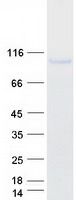 Coomassie blue staining of purified TLR4 protein (Cat# TP322820). The protein was produced from HEK293T cells transfected with TLR4 cDNA clone (Cat# <a href = "https://www.origene.com/catalog/cdna-clones/expression-plasmids/rc222820-tlr4-nm-138554-human-tagged-orf-clone" title="RC222820" class="">RC222820</a>) using MegaTran 2.0 (Cat# <a href = "https://www.origene.com/catalog/others/transfection-reagents/tt210002-megatran-20-plasmid-dna-transfection-reagent-05-ml" title="TT210002" class="">TT210002</a>).