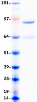 Coomassie blue staining of purified DNMT3B protein (Cat# TP323206). The protein was produced from HEK293T cells transfected with DNMT3B cDNA clone (Cat# <a href = "https://www.origene.com/catalog/cdna-clones/expression-plasmids/rc223206-dnmt3b-nm-006892-human-tagged-orf-clone" title="RC223206" class="">RC223206</a>) using MegaTran 2.0 (Cat# <a href = "https://www.origene.com/catalog/others/transfection-reagents/tt210002-megatran-20-plasmid-dna-transfection-reagent-05-ml" title="TT210002" class="">TT210002</a>).