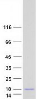 Coomassie blue staining of purified SERF1A protein (Cat# <a href = "https://www.origene.com/catalog/proteins/recombinant-proteins/tp324986-small-edrk-rich-factor-1-serf1a-nm-022968-human-recombinant-protein" title="TP324986" class="">TP324986</a>). The protein was produced from HEK293T cells transfected with SERF1A cDNA clone (Cat# <a href = "https://www.origene.com/catalog/cdna-clones/expression-plasmids/rc224986-small-edrk-rich-factor-1-serf1a-nm-022968-human-tagged-orf-clone" title="RC224986" class="">RC224986</a>) using MegaTran 2.0 (Cat# <a href = "https://www.origene.com/catalog/others/transfection-reagents/tt210002-megatran-20-plasmid-dna-transfection-reagent-05-ml" title="TT210002" class="">TT210002</a>).