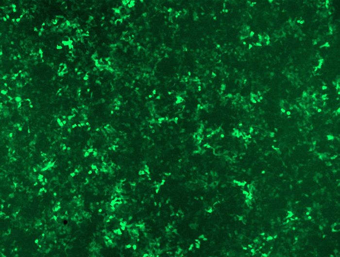 GFP signal was observed under microscope at 48 hours after transduction of TL512864A virus into HEK293 cells. TL512864A virus was prepared using lenti-shRNA TL512864A and <a href = "https://www.origene.com/catalog/others/lentiviral-packaging-kits/tr30037-lentiviral-packaging-kits" title="TR30037" class="">TR30037</a> packaging kit.