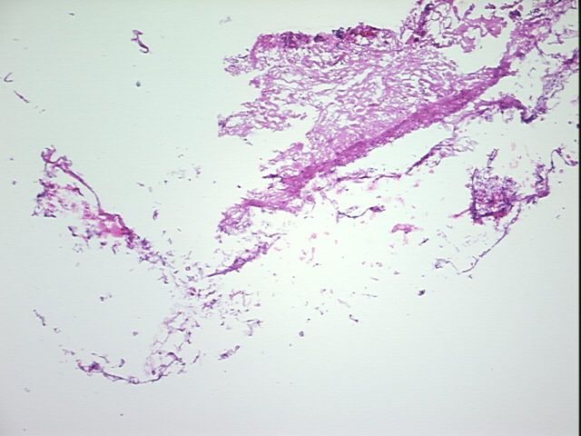 4x Image