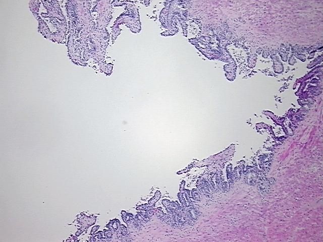 4x Image