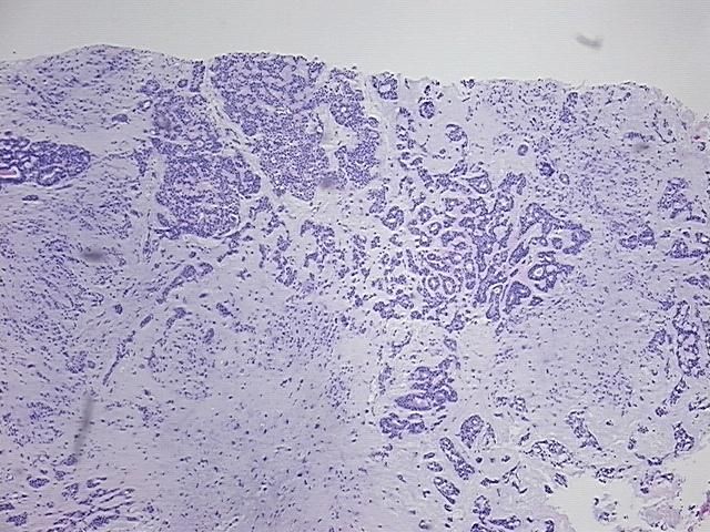 4x Image