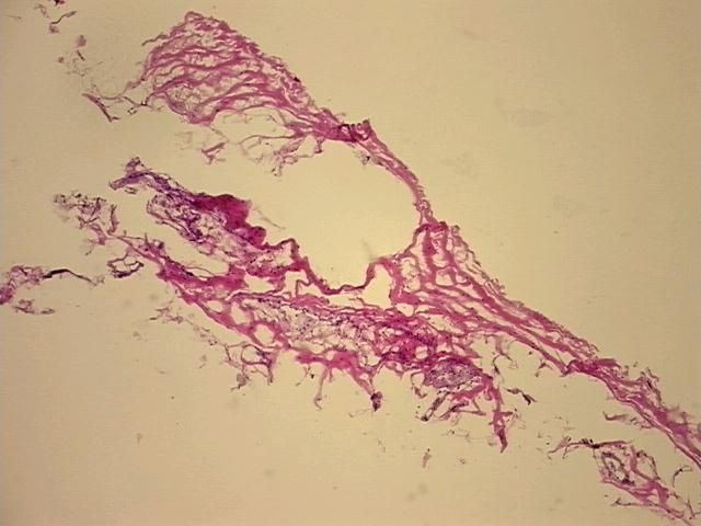 4x Image