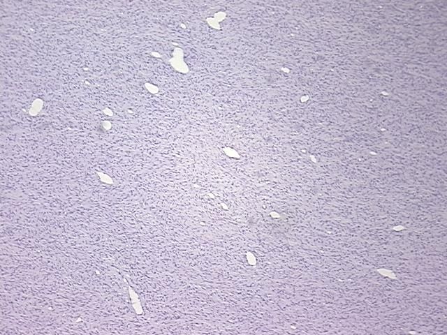 4x Image