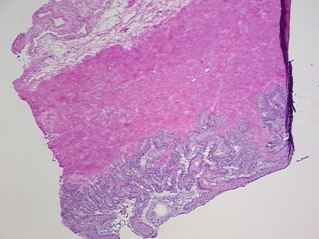 4x Image