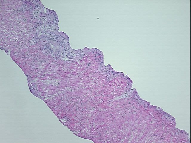 4x Image