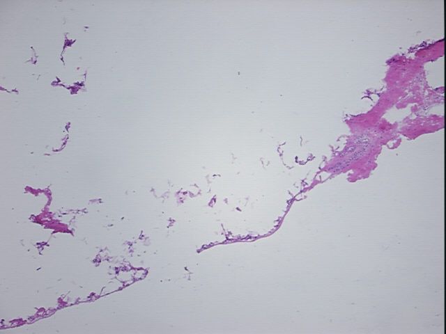 4x Image