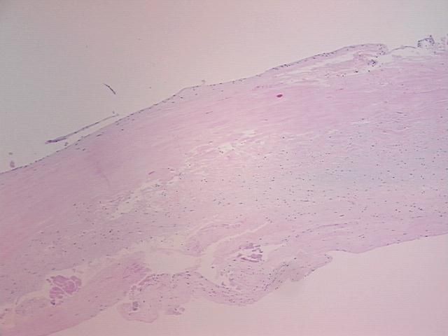 4x Image
