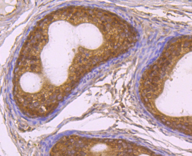 Anti-RAD51 Antibody (4A386)