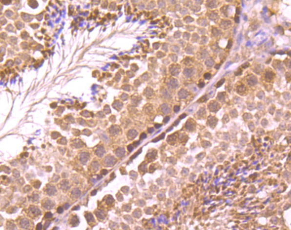 Anti-RAD51 Antibody (4A386)