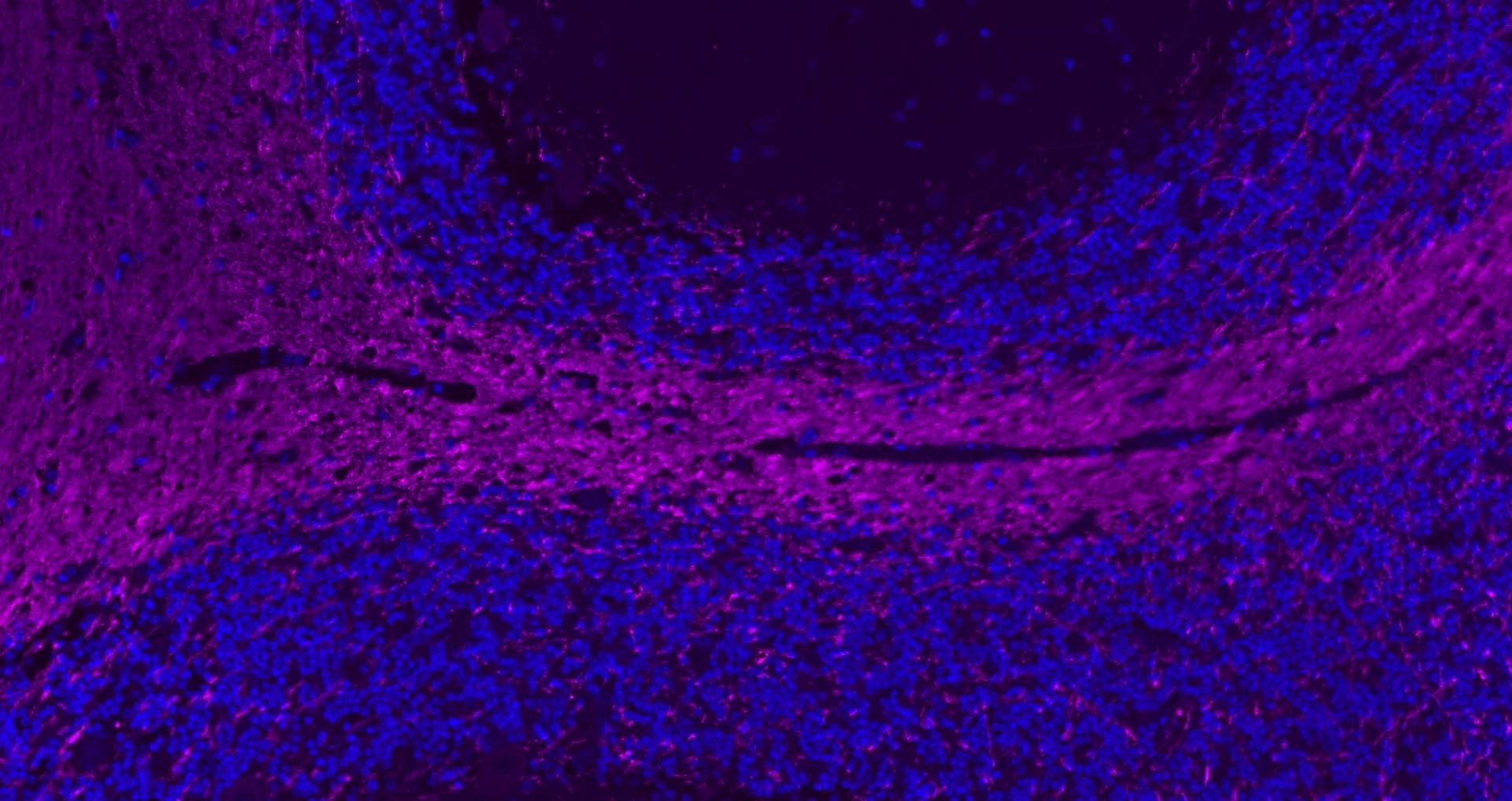 Anti-MBP Polyclonal Antibody