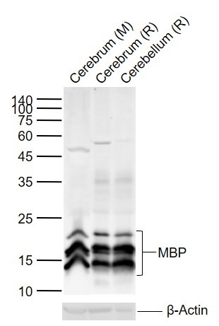 Anti-MBP Polyclonal Antibody