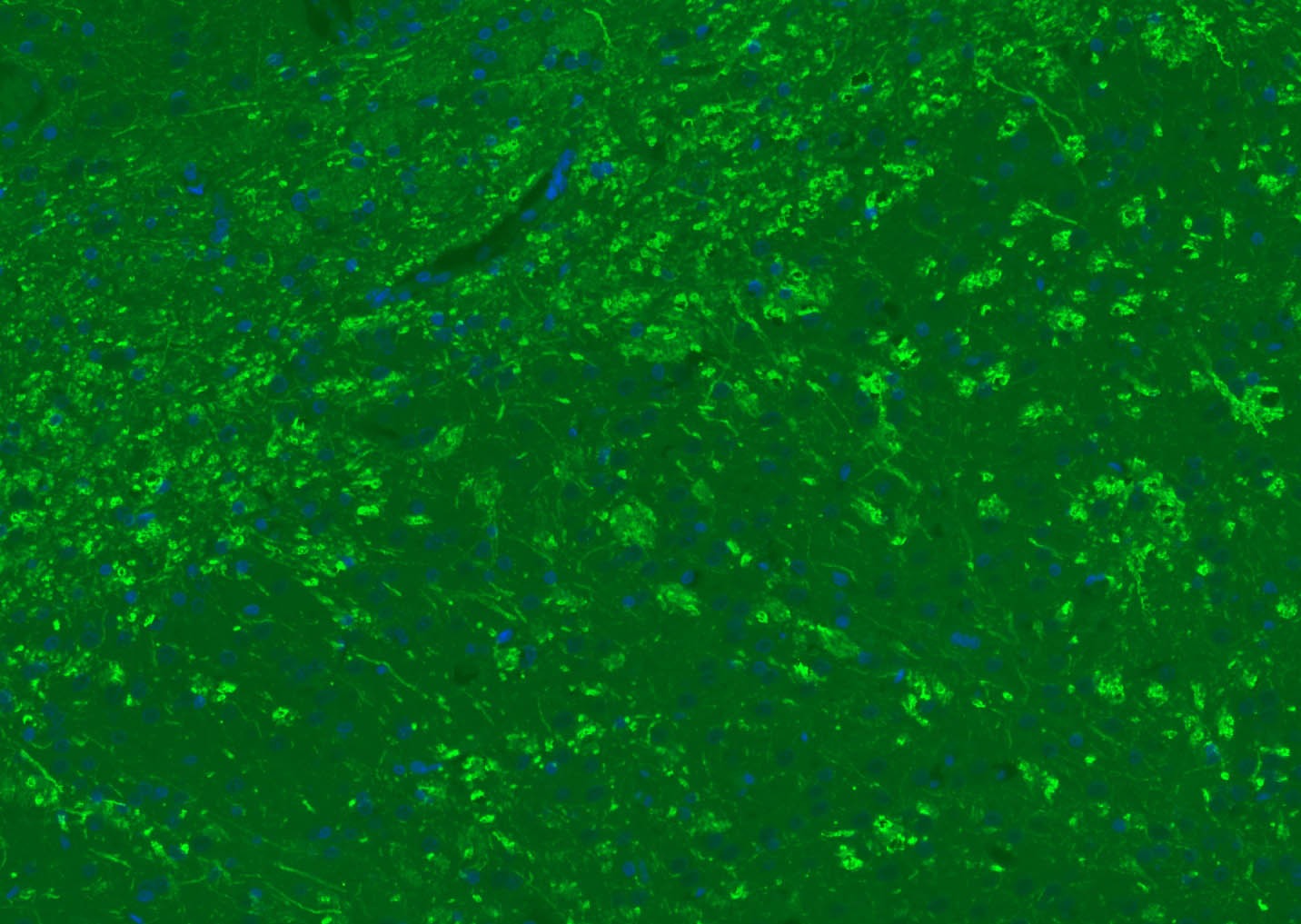 Anti-MBP Polyclonal Antibody 2