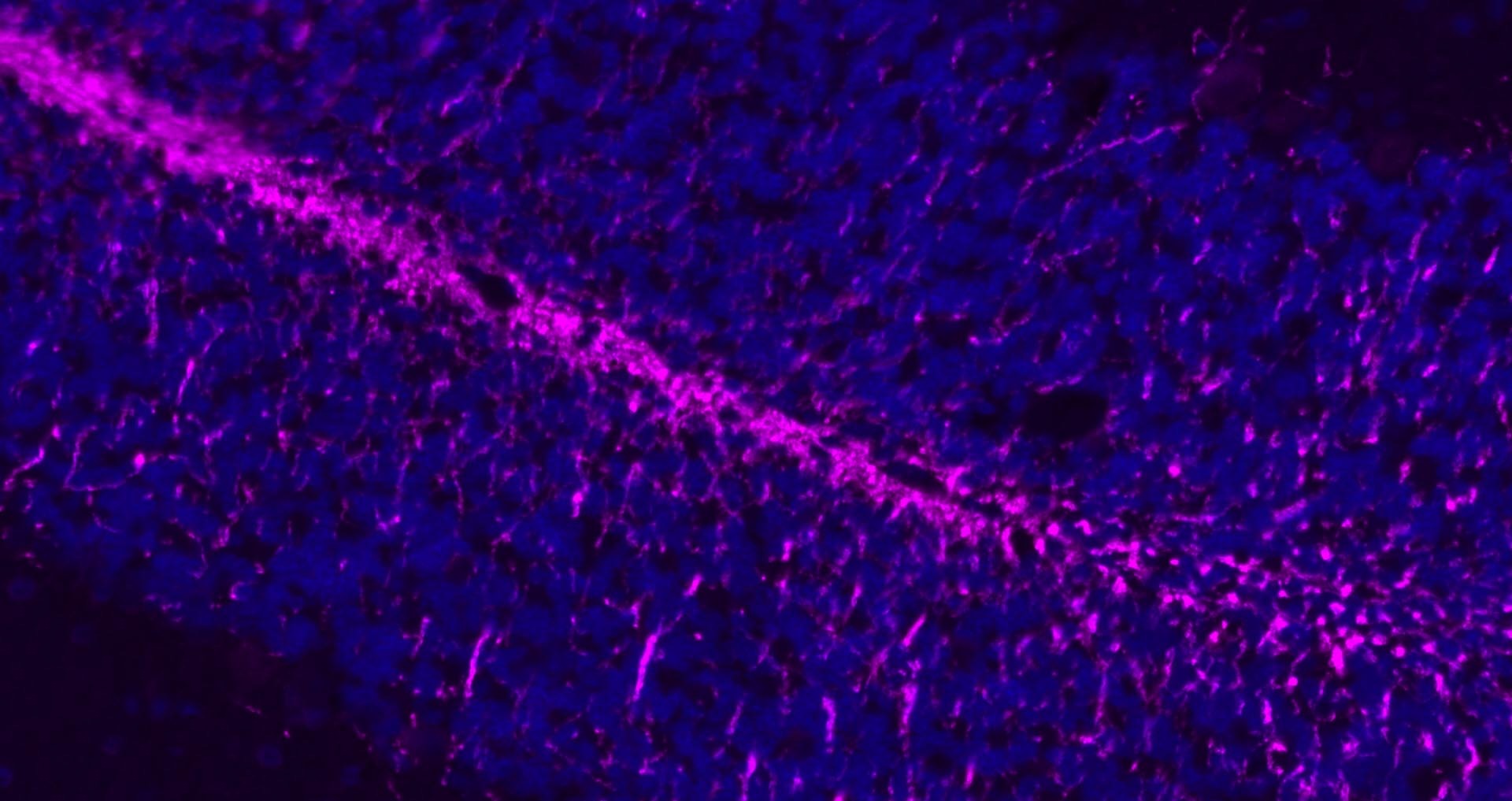 Anti-MBP Polyclonal Antibody 2