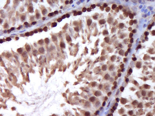 Anti-Stra8 Polyclonal Antibody