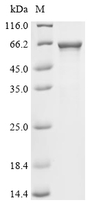 CYP11A1 Protein, Human, Recombinant (His & SUMO)