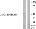 Western blot analysis of lysates from 293 cells, treated with TNF-a 20ng/ml 30', using GSK3 alpha/beta Antibody. The lane on the right is blocked with the synthesized peptide.