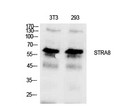 Western blot analysis of NIH-3T3 and 293 cells using Stra8 polyclonal antibody. Antibody was diluted at 1:1000. STJ97252