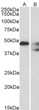 STJ70929 (1µg/ml) staining of Human Cerebellum (A) and Mouse spinal <style>.product-options .custom-field{display:inline-block;background:#aaa;}</style><style>.label-data{font-weight:bold;min-width:100px;}.label-data,.data{display:inline-block;min-width:100px;}.description table{word-break:break-all;}.description table td{min-width:200px;}</style></div></div></div>
				      </div>
                      </div>
  </div>

    </div>




<div class=