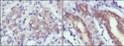 Immunohistochemistry analysis of paraffin-embedded human gastric cancer (left) and normal gastric tissues (right) with DAB staining using Cerberus monoclona<style>.product-options .custom-field{display:inline-block;background:#aaa;}</style><style>.label-data{font-weight:bold;min-width:100px;}.label-data,.data{display:inline-block;min-width:100px;}.description table{word-break:break-all;}.description table td{min-width:200px;}</style></div></div></div>
				      </div>
                      </div>
  </div>

    </div>




<div class=