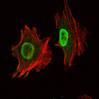 Immunofluorescence analysis of NTERA-2 cells using Oct-3/4 monoclonal antibody (green). Red: Actin filaments have <style>.product-options .custom-field{display:inline-block;background:#aaa;}</style><style>.label-data{font-weight:bold;min-width:100px;}.label-data,.data{display:inline-block;min-width:100px;}.description table{word-break:break-all;}.description table td{min-width:200px;}</style></div></div></div>
				      </div>
                      </div>
  </div>

    </div>




<div class=