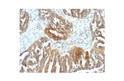 Anti-VEGF antibody [VEGF-21] (STJ16101009)