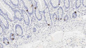 Anti-Chromogranin A antibody [5H7] (STJ16101718)