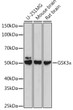 Western blot analysis of various lysates using [KO Validated] GSK3 Alpha Rabbit polyclonal antibody (STJ11102944) at 1:500 dilution. Secondary antibody: HRP Goat Anti-Rabbit IgG (H+L) (STJS000856) at 1:10000 dilution. Lysates/proteins: 25 Mu g per lane. Blocking buffer: 3% nonfat dry milk in TBST. Detection: ECL Basic Kit. Exposure time: 5s.