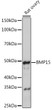 Western blot analysis of extracts of Rat ovary, using BMP15 Rabbit monoclonal antibody (STJ11102004) at 1:1000 dilution. Seco<style>.product-options .custom-field{display:inline-block;background:#aaa;}</style><style>.label-data{font-weight:bold;min-width:100px;}.label-data,.data{display:inline-block;min-width:100px;}.description table{word-break:break-all;}.description table td{min-width:200px;}</style></div></div></div>
				      </div>
                      </div>
  </div>

    </div>



<script>
			var searchid = 