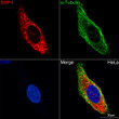 Confocal im<style>.product-options .custom-field{display:inline-block;background:#aaa;}</style><style>.label-data{font-weight:bold;min-width:100px;}.label-data,.data{display:inline-block;min-width:100px;}.description table{word-break:break-all;}.description table td{min-width:200px;}</style></div></div></div>
				      </div>
                      </div>
  </div>

    </div>




<div class=
