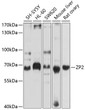 Western blot analysis of extracts of various cell lines, using ZP2 antibody (STJ112165) at 1:1000 dilution. Secondary antibody: HRP Goat Anti-rabbit IgG (H+L) (STJS000856) at 1:10000 dilution. Lysates/proteins: 25 Mu g per lane. Blocking buffer: 3% non-fat dry milk in TBST. Detection: ECL Basic Kit. Exposure time: 10s.