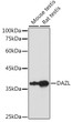 Western blot analysis of extracts of various cell lines, using DAZL antibody (STJ115905) at 1:1000 dilution. Secondary antibody: HRP Goat Anti-rabbit IgG (H+L) (STJS000856) at 1:10000 dilution. Lysates/proteins: 25 Mu g per lane. Blocking buffer: 3% non-fat dry milk in TBST. Detection: ECL Basic Kit. Exposure time: 10s.