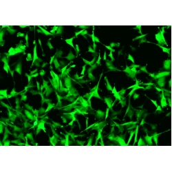 Human Primary Mammary Fibroblasts
