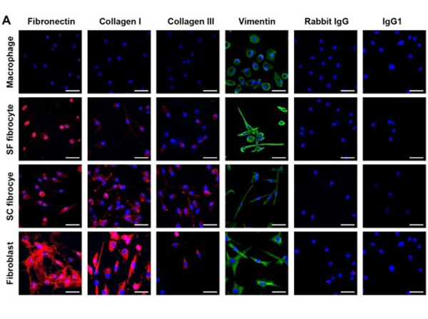 Immunofluorescence using Collagen Type III