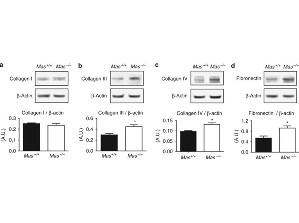 Western Blot using Collagen Type III
