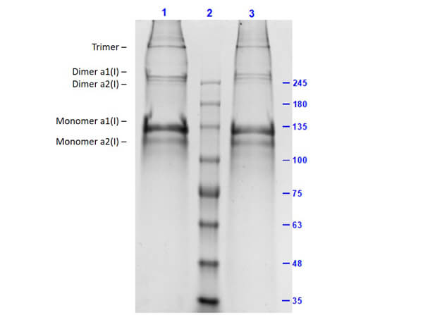 Human Collagen Type I
