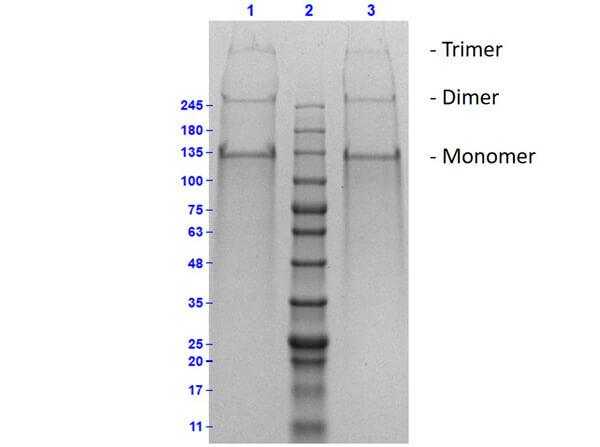 Human Collagen Type II