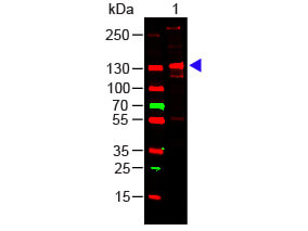 COLLAGEN III - Western Blot