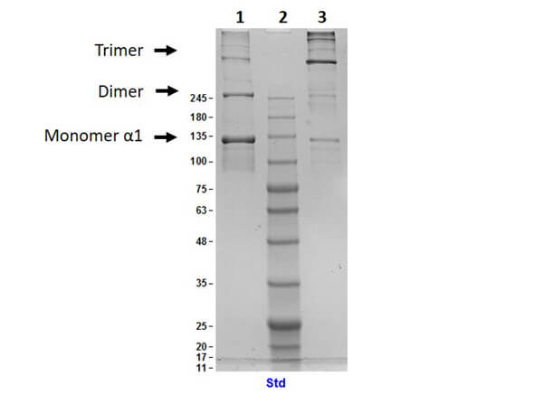 Human Collagen Type III