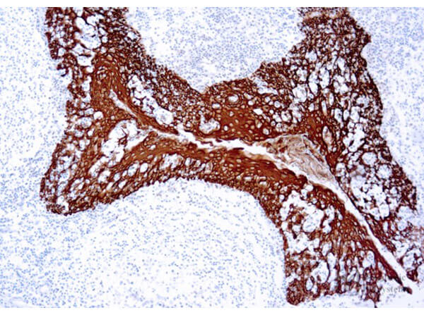 Immunohistochemistry of using Stable DAB/Plus of human tonsil.