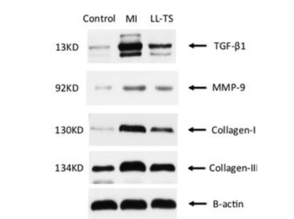 RIPA used for western blot