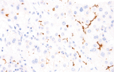 Anti-BSEP CE/IVD para IHC - Patologia gastrointestinal