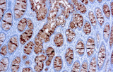 Anti-CA 19-9 CE/IVD para IHC - Patologia gastrointestinal