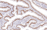 Anti-CDX-2 CE/IVD para IHC - Patologia gastrointestinal