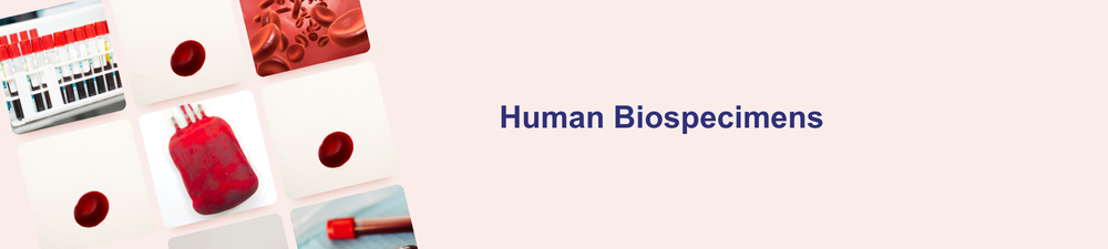 Banner de Nanopartículas Lipídicas